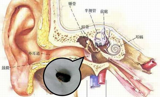 蟑螂進(jìn)入耳朵的概率大嗎|滅蟑|廣州滅蟑